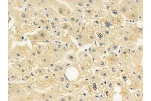 anti-Unc-5 Homolog C (C. Elegans) (Unc5c) (N-Term) antibody