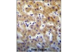 KT Antibody (C-term) (ABIN655129 and ABIN2844756) immunohistochemistry analysis in formalin fixed and paraffin embedded human liver tissue followed by peroxidase conjugation of the secondary antibody and DAB staining. (KRTCAP2 Antikörper  (C-Term))