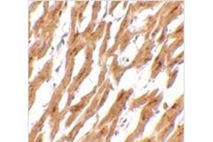 Immunohistochemistry of ASAH1 in human heart tissue with ASAH1 antibody at 2. (ASAH1 Antikörper  (C-Term))