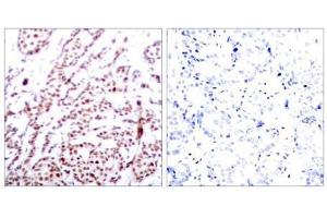 Image no. 1 for anti-Activating Transcription Factor 2 (ATF2) (pThr55), (pThr73) antibody (ABIN196669) (ATF2 Antikörper  (pThr55, pThr73))
