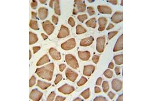 Immunohistochemistry analysis in skeletal muscle (Formalin-fixed, Paraffin-embedded) using TECR / GPSN2  Antibody (C-term), followed by peroxidase conjugation of the secondary antibody and DAB staining. (TECR Antikörper  (C-Term))