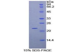 SDS-PAGE (SDS) image for Cyclophilin B (PPIB) (AA 25-207) protein (His tag) (ABIN1079327)
