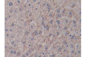 Immunohistochemistry (IHC) image for anti-Nephrosis 1, Congenital, Finnish Type (Nephrin) (NPHS1) (AA 23-92) antibody (ABIN7432916)