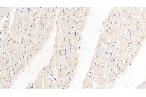 Detection of PDL1 in Human Cardiac Muscle Tissue using Monoclonal Antibody to Programmed Cell Death Protein 1 Ligand 1 (PDL1) (PD-L1 Antikörper  (AA 24-234))