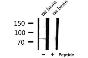 Western blot analysis of extracts from rat brain, using TLE1 Antibody. (TLE1 Antikörper  (Internal Region))