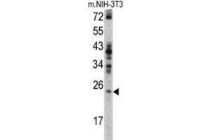Western Blotting (WB) image for anti-RAN, Member RAS Oncogene Family (RAN) antibody (ABIN3002753) (RAN Antikörper)