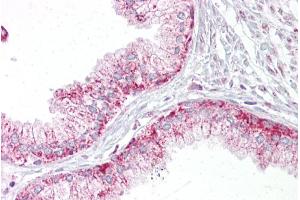 Immunohistochemistry with Prostate tissue at an antibody concentration of 5µg/ml using anti-AURKA antibody (ARP30876_P050) (Aurora A Antikörper  (C-Term))