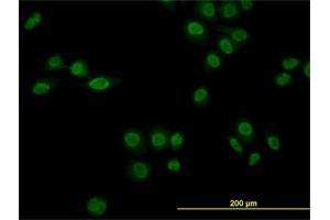 Immunofluorescence of monoclonal antibody to NR1D1 on HeLa cell.