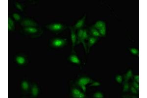 Immunofluorescent analysis of Hela cells using ABIN7168309 at dilution of 1:100 and Alexa Fluor 488-congugated AffiniPure Goat Anti-Rabbit IgG(H+L) (RBMY1A1 Antikörper  (AA 1-459))
