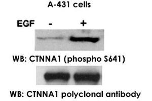 Western blot analysis of extract from A-431 cells, untreated ortreated with EGF (200ng/ml, 30min), using CTNNA1 polyclonal antibody  and CTNNA1 (phospho S641) polyclonal antibody .