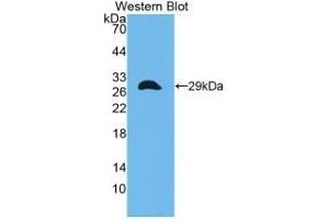 Detection of Recombinant CITED1, Mouse using Polyclonal Antibody to Cbp/p300 Interacting Transactivator, With Glu/Asp Rich Carboxy Terminal Domain 1 (CITED1) (CITED1 Antikörper  (AA 1-203))