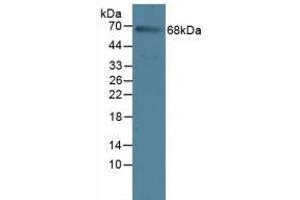 Detection of IL23R in Rat Serum Tissue using Polyclonal Antibody to Interleukin 23 Receptor (IL23R) (IL23R Antikörper  (AA 25-355))
