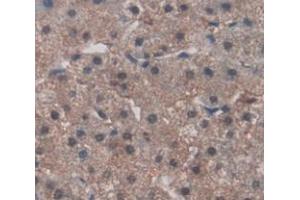 Immunohistochemistry (Paraffin-embedded Sections) (IHC (p)) image for anti-Fibronectin Type III Domain Containing 5 (FNDC5) (AA 2-137) antibody (ABIN2929323)