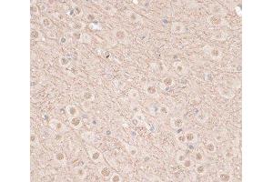 Immunohistochemistry of paraffin-embedded Mouse brain using VEGF Receptor 2 Polyclonal Antibody at dilution of 1:100 (40x lens). (VEGFR2/CD309 Antikörper)