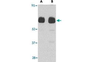 Western blot analysis of UNC93B1 in human heart tissue lysate with UNC93B1 polyclonal antibody  at (A) 0. (UNC93B1 Antikörper  (N-Term))