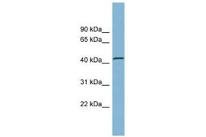 TBC1D13 antibody used at 1 ug/ml to detect target protein. (TBC1D13 Antikörper  (Middle Region))