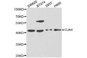 Western blot analysis of extracts of various cell lines, using GJA4 antibody. (GJA4 Antikörper  (AA 229-333))