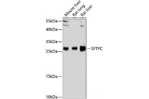 Western blot analysis of extracts of various cell lines using SFTPC Polyclonal Antibody at dilution of 1:1000. (Surfactant Protein C Antikörper)