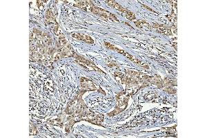 IHC analysis of RTCB using anti-RTCB antibody (ABIN7600722).