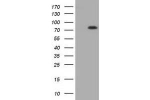 HEK293T cells were transfected with the pCMV6-ENTRY control (Left lane) or pCMV6-ENTRY C17orf28 (Right lane) cDNA for 48 hrs and lysed. (HID1/DMC1 Antikörper)