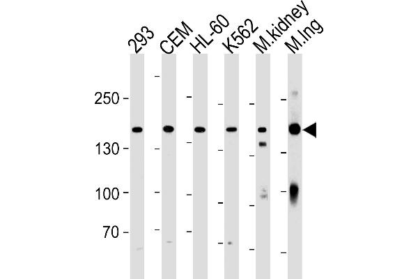 Plakophilin 4 Antikörper  (C-Term)