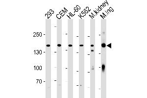 PKP4 Antibody (C-term) (ABIN1881657 and ABIN2843435) western blot analysis in 293,CEM,HL-60,K562 cell line and mouse kidney,lung tissue lysates (35 μg/lane).