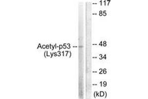 Western blot analysis of extracts from HeLa cells, treated with TSA 400nM 24h, using p53 (Acetyl-Lys317) Antibody. (p53 Antikörper  (acLys317))