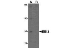 Image no. 2 for anti-Interleukin-27 subunit beta (IL-27b) (C-Term) antibody (ABIN341717) (EBI3 Antikörper  (C-Term))