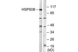 Western Blotting (WB) image for anti-Heat Shock Protein 90kDa alpha (Cytosolic), Class B Member 1 (HSP90AB1) (Ser254) antibody (ABIN1847890) (HSP90AB1 Antikörper  (Ser254))