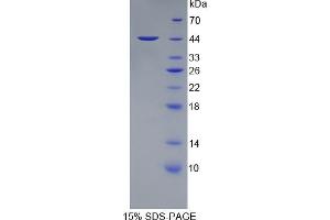 SDS-PAGE analysis of Human PTPRC Protein. (CD45 Protein)