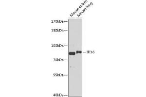 Western blot analysis of extracts of various cell lines, using IFI16 antibody (ABIN6129036, ABIN6142162, ABIN6142163 and ABIN6218202) at 1:1000 dilution. (IFI16 Antikörper  (AA 1-300))
