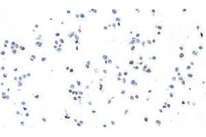 anti-Transcription Factor MafB (MAFB) (AA 1-50) antibody