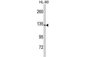 Western blot analysis of C5 Antibody