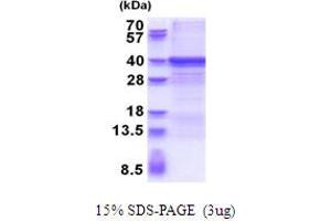 SDS-PAGE (SDS) image for ZW10 Interactor (ZWINT) (AA 1-230) protein (His tag) (ABIN6387417)