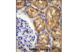 Immunohistochemistry (Paraffin-embedded Sections) (IHC (p)) image for anti-Argininosuccinate Synthase 1 (ASS1) (AA 281-310), (C-Term) antibody (ABIN656537)