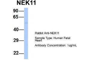 Host:  Rabbit  Target Name:  NEK11  Sample Type:  Human Fetal Heart  Antibody Dilution:  1. (NEK11 Antikörper  (Middle Region))