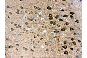 Anti- PGP9. (UCHL1 Antikörper  (C-Term))