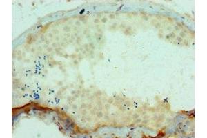 Immunohistochemistry of paraffin-embedded human testis tissue using ABIN7166161 at dilution of 1:100 (SSX2 Antikörper  (AA 1-188))