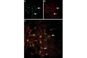 Multiplex staining of VMAT2 and TRPC3 in rat brain - Immunohistochemical staining of perfusion-fixed frozen rat substantia nigra sections using Anti-VMAT2-ATTO Fluor-488 Antibody (ABIN7043689), (1:60) and Anti-TRPC3-ATTO Fluor-594 Antibody (ABIN7043819), (1:60). (TRPC3 Antikörper  (C-Term, Intracellular) (Atto 594))