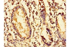 Immunohistochemistry of paraffin-embedded human appendix tissue using ABIN7142262 at dilution of 1:100 (MRPS28 Antikörper  (AA 72-187))