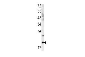 Western blot analysis of GCG antibody (N-term) (ABIN390411 and ABIN2840800) in mouse bladder tissue lysates (35 μg/lane). (Glucagon Antikörper  (N-Term))