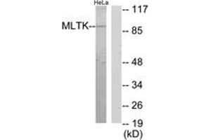 Western blot analysis of extracts from HeLa cells, using MLTK Antibody. (ZAK Antikörper  (AA 701-750))