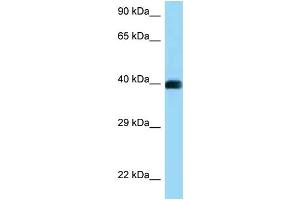 WB Suggested Anti-CD72 Antibody Titration: 1. (CD72 Antikörper  (C-Term))
