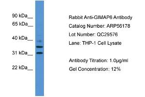 WB Suggested Anti-GIMAP6  Antibody Titration: 0. (GIMAP6 Antikörper  (C-Term))