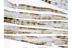 IHC analysis of ACTN3/Alpha Actinin 3 using anti- ACTN3/Alpha Actinin 3 antibody . (ACTN3 Antikörper  (C-Term))