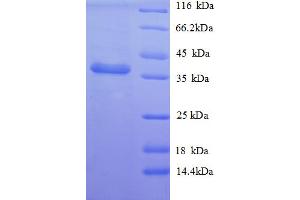 SDS-PAGE (SDS) image for Nerve Growth Factor Receptor (TNFRSF16) Associated Protein 1 (NGFRAP1) (AA 1-111), (full length) protein (GST tag) (ABIN5710009) (Nerve Growth Factor Receptor (TNFRSF16) Associated Protein 1 (NGFRAP1) (AA 1-111), (full length) protein (GST tag))