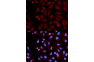 Immunofluorescence analysis of U2OS cells using MAOB antibody (ABIN5970749). (Monoamine Oxidase B Antikörper)