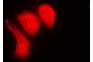 Immunofluorescent analysis of hnRNP K (pS284) staining in Raw264. (HNRNPK Antikörper  (pSer284))