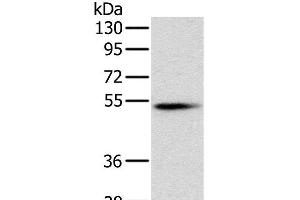 Western Blot analysis of Mouse pancreas tissue using PNLIP Polyclonal Antibody at dilution of 1:400 (PNLIP Antikörper)