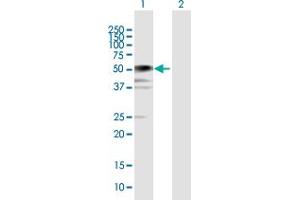 Western Blot analysis of BCCIP expression in transfected 293T cell line by BCCIP MaxPab polyclonal antibody. (BCCIP Antikörper  (AA 1-322))